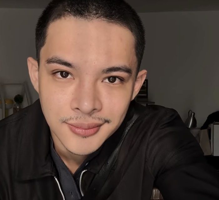 Rey Mbayang: Perjuangannya Menghadapi Autoimun Psoriasis
